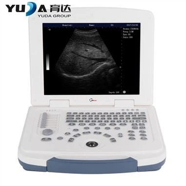 Mesin Pengimbas Ultrabunyi Digital Komputer Riba 3D