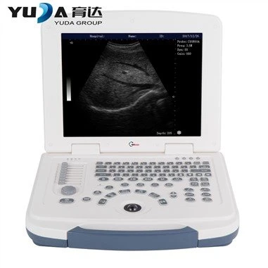 Full Digital Laptop High-end Ultrasound 3D Pengimbas